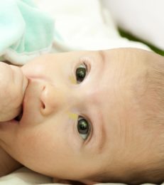 Sticky Eyes In Babies: Causes, Treatment, Remedies And Prevention