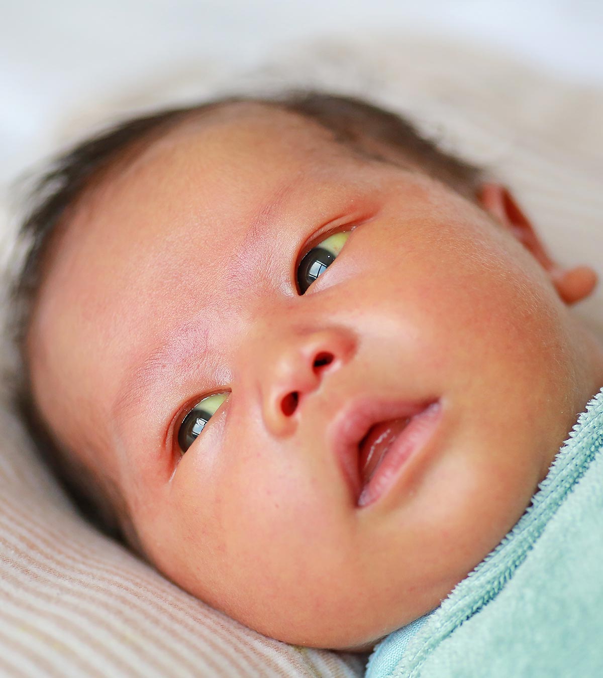 Biliary Atresia In Newborns: Symptoms, Causes And Treatment