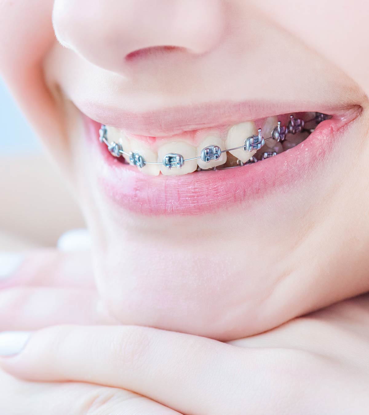 Braces For Kids: Right Age To Get Them And Dental Care To Take