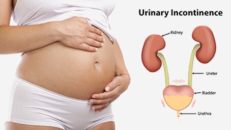 Urinary Incontinence During Pregnancy - Everything You Need To Know About It